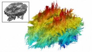 Diffusion Tensor Imaging of the Brain's White Matter