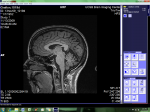 Nice to know that my brain looks pretty normal....