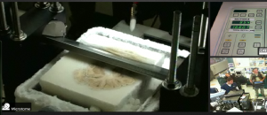 The Microtome Making a Slice of H.M.'s Brain